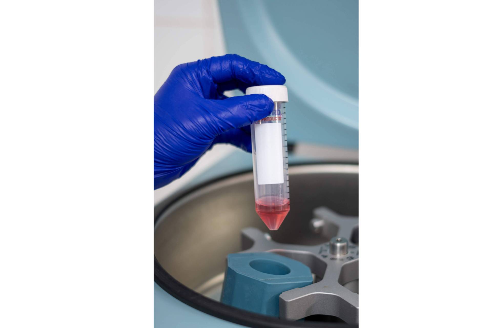 ONCOVIX; Nuevos avances en inmunoterapia DEX personalizada para cáncer
